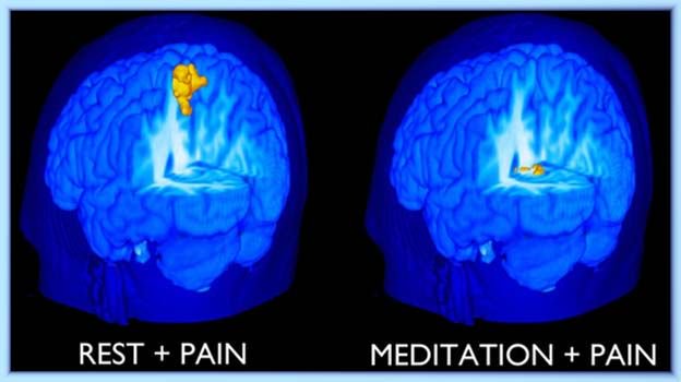 cervello mindfullness meditazione